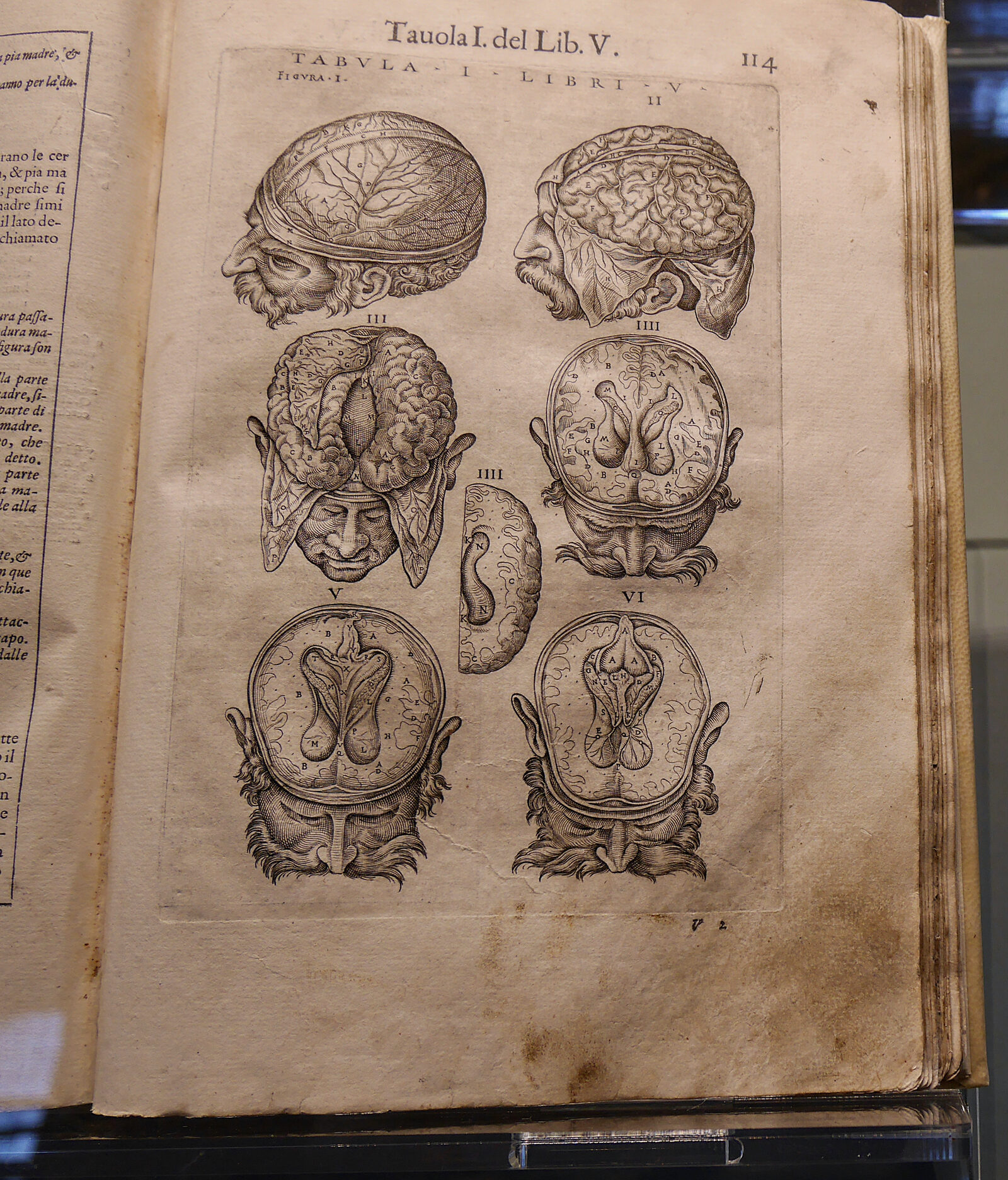 Scuola di San Marco : The medical museum houses over 8,000 medical tomes, including works by ancient physicians such as Hippocrates